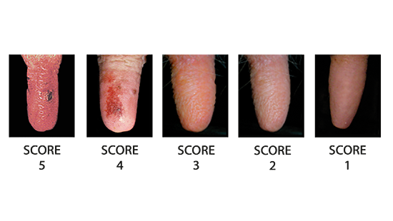 Teat Conditions